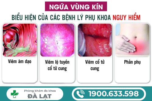 Hình ảnh minh họa